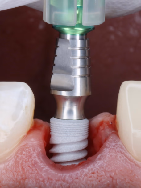 oA1mfmJRsPPk8bF7aWpfMGcFxQ